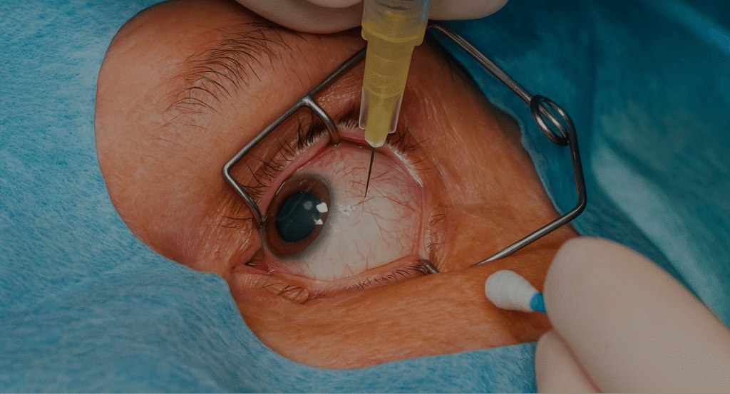 Inyecciones Intravítreas